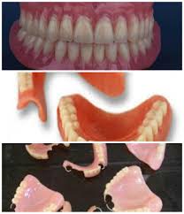 Asesor twk kpk gebrak meja, lecehkan perempuan. Babeh Dental Pasang Gigi Palsu Di Karawang