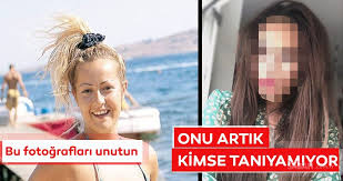 We did not find results for: Hulya Avsar In Kardesi Helin Avsar I Artik Kimse Taniyamiyor Helin Avsar A Estetik Operasyonlari Yaramadi Galeri Magazin