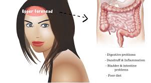 Face Mapping Acne Chinese Causes And Remedies Of Acne