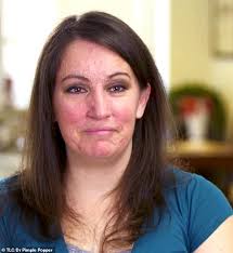 Dr Pimple Popper removes 20-year-old lumps from woman's face