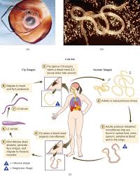 protozoan and helminthic infections of the skin and eyes