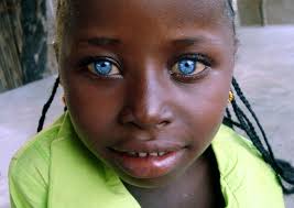 Brown Skin Blond Hair 26 Of The Melanesian People On The Solomon Islands Are Blonds People With Blue Eyes Blue Eyes Blonde Hair Blue Eyes