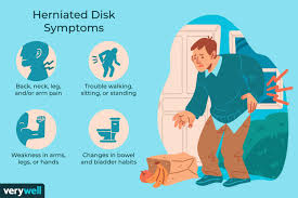 We did not find results for: Herniated Disc Surgery Overview