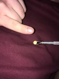 We did not find results for: My Husband Has Had Really Bad Breath For The Last 6 Months I Pulled This Out Of His Tonsils Tonight He Didn T Think Tonsil Stones Were A Thing Pointer Finger For Scale Popping