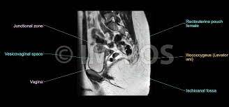 We did not find results for: Mri Of The Female Pelvis