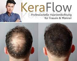 Keraflow Streuhaar Fur Volle Und Dichte Haare Schutthaar Zur Haarverdichtung Haarfaser Gegen Lichte Stellen Bei Haarausfall 28g Mittelbraun Amazon De Beauty