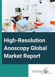 Image result for Anoscopy