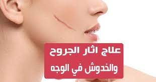 علاج اثار الجروح والخدوش في الوجه تتعرض البشرة إلى العديد من العوامل المختلفة التي تؤثر على مظهرها وجمالها وخصوصا العوامل العرضية movie posters movies poster