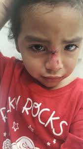 What happened to Isiah's face?