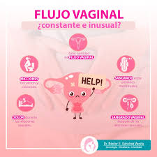Flujo Vaginal Constante E Inusual Podrias Tener Cervicitis La Mayoria De Las Veces La Cervicitis No Provoca Signos Ni Sintomas De Modo Que Es Posible Que Solo Te Enteres De Que Tienes