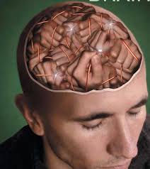 Exercise as Medicine Essentials for Parkinson Disease The WHY and HOW!