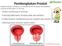 Membantu didalam masalah kencing tidak lawas/tidak lancar membantu mengecutkan kalenjar prostat yang bengkak membantu meningkatkan fungsi pundi kencing dan melancarkan. Kencing Tak Lawas Di Kalangan Warga Emas Lelaki Mungkin Tanda Awal Masalah Prostat Genkimomma My