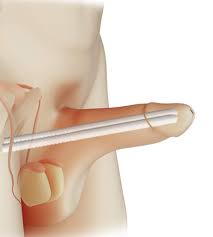 CİNSEL SAĞLIK – Üroloji Profesörü Üroloji Uzmanı Prof. Dr. Saadettin  Eskiçorapcı