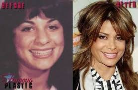 Paula Abdul Before And After Plastic Surgery Celebrity Surgery Plastic Surgery Celebrity Plastic Surgery