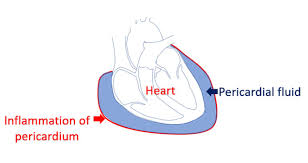 Image result for Pericardium