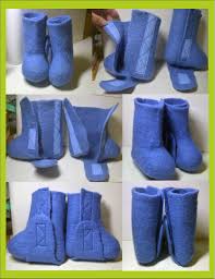 Kids clubfoot support boots and brace by yishybearcreations. Velcro Felt Shoes For Children With Clubfoot At The Brace Club Foot Baby New Baby Products Baby Fisher