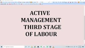 Image result for Active Management of Labor