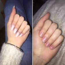 Dazu am besten einen nagelhärter auftragen, der stärkt weiche, dünne nägel und lässt sie kräftiger wachsen. Pause Von Gelnageln Nagel Hasslich Gelnagel