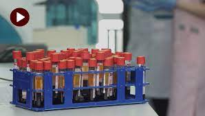 The Do S And Don Ts Of Fasting Before Routine Bloodwork Vital Record