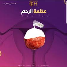 عضمة الرحم كيف يكون هناك عضمة في الرحم بمرور الوقت ينمو الورم الليفي بشكل كبير بحيث لا تستطيع الأوعية الدموية تغذية الورم movie posters movies sao