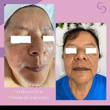 Genesis Serrano Cosmetica