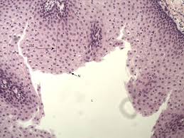Maybe you would like to learn more about one of these? Human Esphagus Stratified Squamous Epithelium 10x Histology