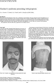 Image result for Gardner Sendromu