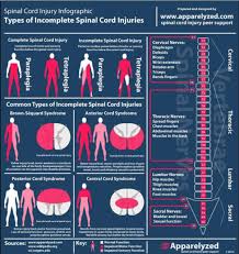 A Chart On Spinal Cord Injuries Neuroanatomy Infographic