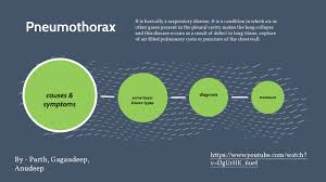 Consult a doctor for medical advice. Pneumothorax By Akshan Matta