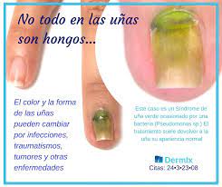 Igualmente puede pasar el limón sobre. Las Unas Son Anexos De Dra Veronica Reyes Derma Facebook