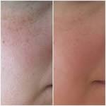 How to Hide Large Pores M