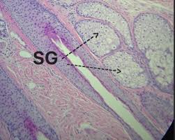 Image result for Sebaceous Gland