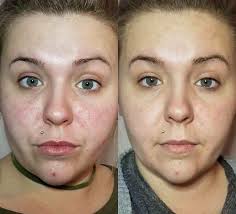 INCASE YOU DINT KNOW! Money is also a skin care product! LWENU!