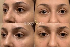 Boss MD Plastic Surgery