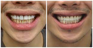 Our general dentistry services take care of the daily dental needs of you and your family. Family Dentistry Near Me Emergency Dental Care Services In Manhattan Affordable Dentist Dentist Near Me Emergency Dentist