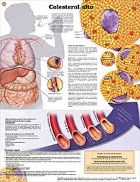High Cholesterol Colesterol Alto Anatomy Poster Colesterol Alto Colesterol Infografia Salud