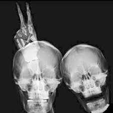 X Ray Selfie Radiology Humor X Ray Xray Art
