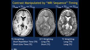 Magnetic resonance imaging (mri) is a medical imaging technique used in radiology to form pictures of the anatomy and the physiological processes of the body. Mri Basics Part 1 Youtube