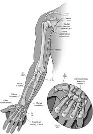 A fracture of the medial epicondyle of the elbow that is the third most common fracture seen in children and is usually seen in boys between the age of 9 and 14. Management Of Ulnar Nerve Injuries Journal Of Hand Surgery