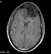 Radiology Quiz 14628 Radiopaedia Org You can track the performance of radiopaedia every hour of every day across different countries, categories and devices. radiopaedia
