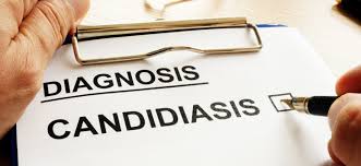 Candida: What It Is, Overgrowth, and How to Get Rid of It | Prospect Medical Systems