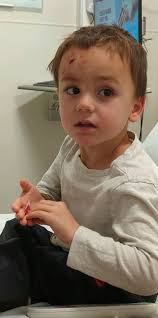 Nothing like getting a call from your husband as soon as you land that your  youngest fell and gashed his head. Straight to the ER from the airport!  He's taking it like