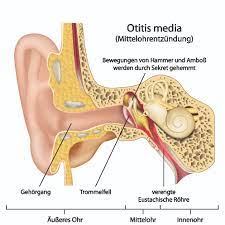 Mittelohrentzundung Otitis Media Symptome Behandlung