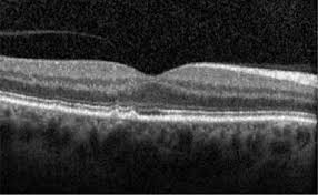 We did not find results for: Age Related Macular Degeneration Medical Clinics