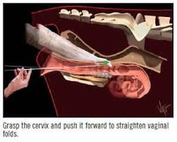 A I Technique In Cattle Dairy Cattle Cattle Cattle Ranching