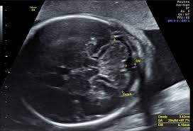 Hallo, ich wende mich heute an sie,weil ich die hoffnung habe , sie können mir helfen. Organultraschall Feindiagnostik Dr Med D Prinz