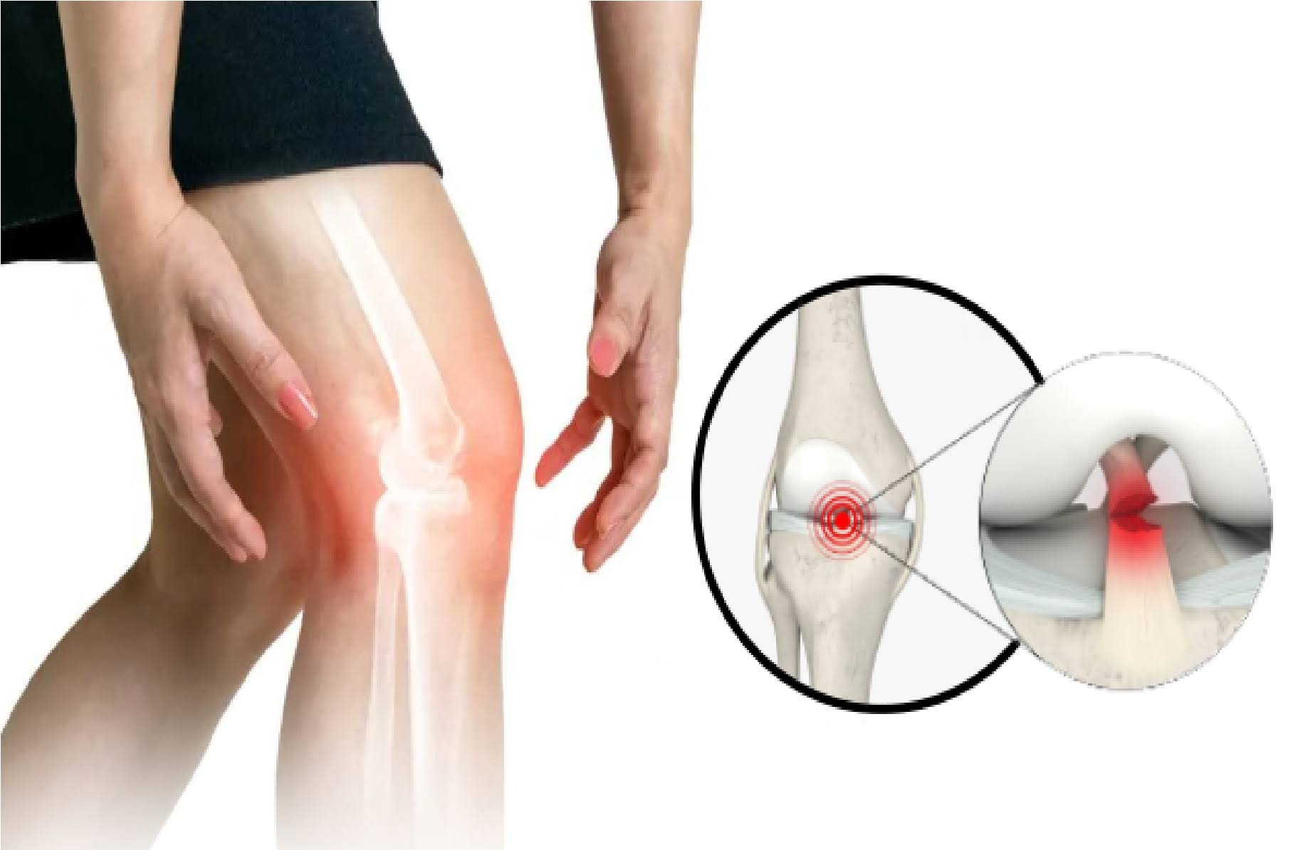 Ligament Injury Treatment product image