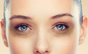 Cara yang biasa dipakai untuk menghilangkan bulu. 7 Cara Mudah Untuk Menghilangkan Eye Bag