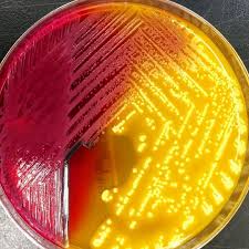 Citrobacter Freundii On X L D Agar Medical Technology Labs Medical Technology Microbiology