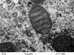 30.10.2018 · microscope bacteria identification. 10 Transmission Electron Microscope Ideas Electron Microscope Microscope Electrons